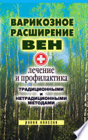 Варикозное расширение вен. Лечение и профилактика традиционными и нетрадиционными методами