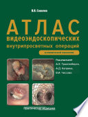 Атлас видеоэндоскопических внутрипросветных операций в клинической онкологии: научно-практическое издание